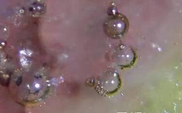 明代汝窑瓷器气泡图片