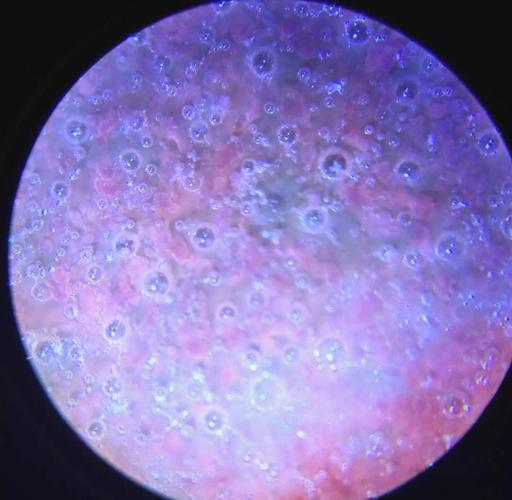 元代瓷器气泡鉴定图片